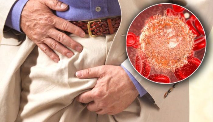 Contoh Benjolan di Selangkangan Penyebab dan Gejalanya