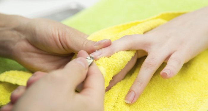 Finger infection felon pulp paronychia fingertip swollen swelling red treatment hand around redness bacterial before one goes