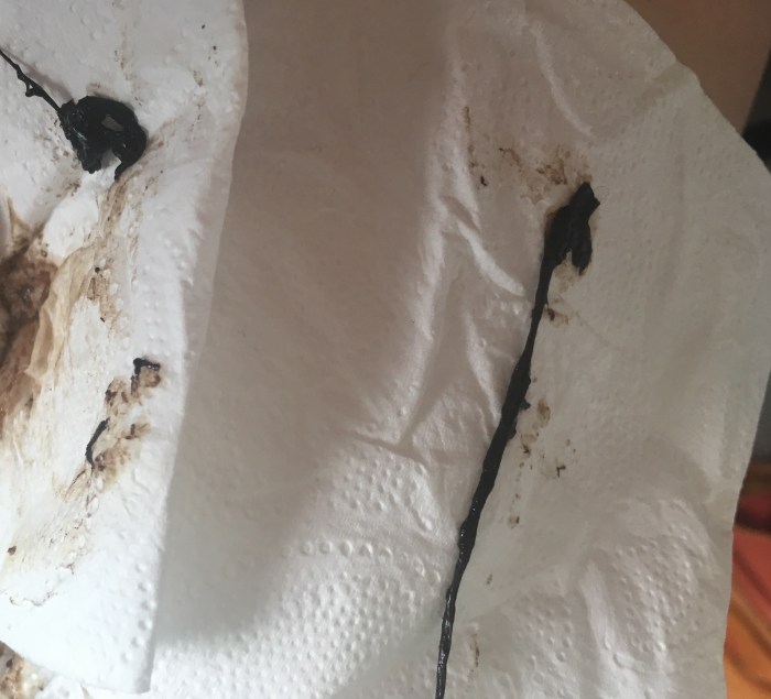 Keluar coklat sebelum haid