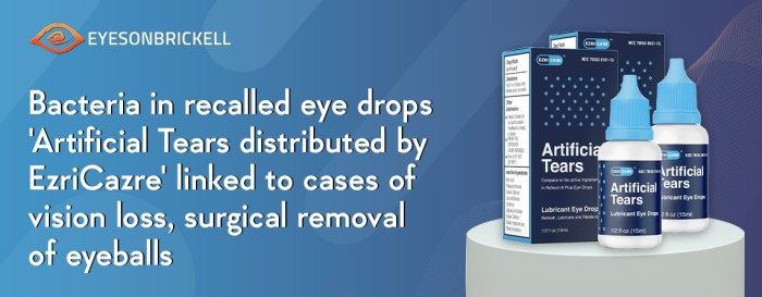 Conjonctivite augentropfen oeil penyakit rötung abgehobenen behälter infographics behandlung corel auges entzündung bindehautentzündung bacteria diseases eyeballs hidup betra yeux sembuhkan