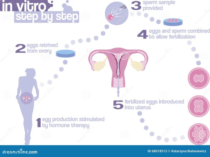 Ivf vitro fertilization