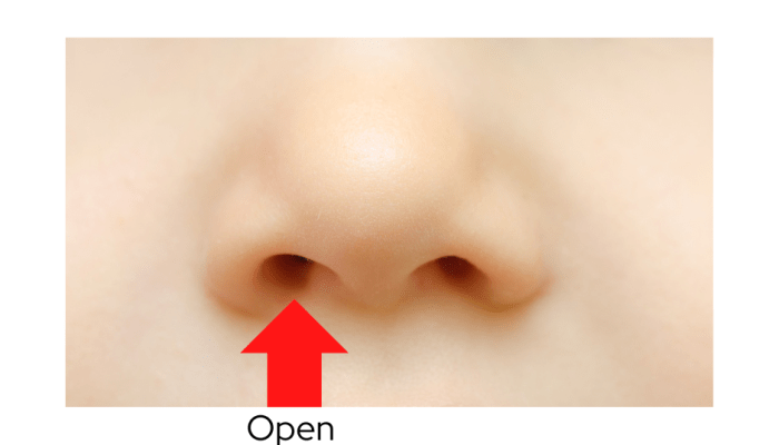 Pernapasan Cuping Hidung Adalah Mekanisme Vital