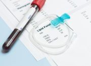 Puasa Sah Tanpa Niat Lisan Hukum dan Syaratnya