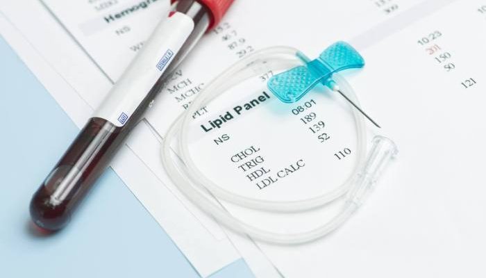 Puasa Sah Tanpa Niat Lisan Hukum dan Syaratnya