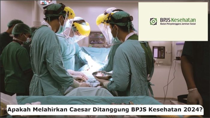 Panduan menghindari persalinan caesar tak tercover BPJS