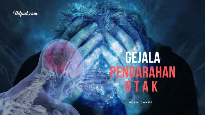 Otak penyebab pendarahan perdarahan