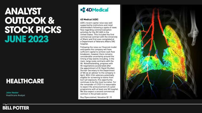 Kebijakan bisnis 4DMedical Reports kuartal 3