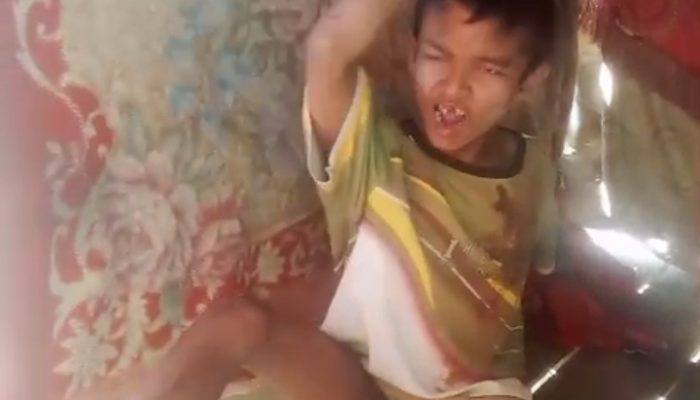Dipasung dan Dirantai, Anak Berkebutuhan Khusus di Langsa Butuh Perhatian Serius Pemerintah